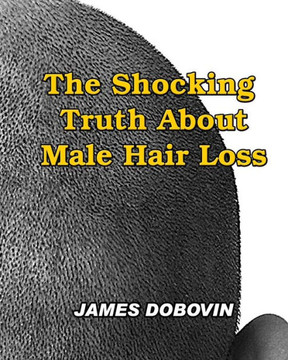 The Shocking Truth About Male Hair Loss: Secrets You Need to Know About Losing Hair So You Can Stop From Going Bald