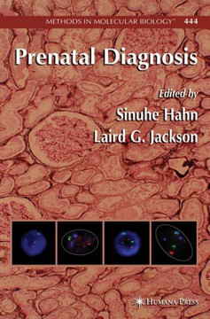 Prenatal Diagnosis