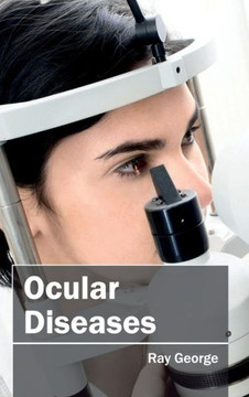 Ocular Diseases Ocular Diseases
