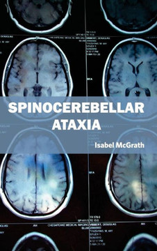 Spinocerebellar Ataxia