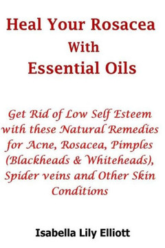 Heal Your Rosacea with Essential Oils : Get Rid of Low Self Esteem with These Natural Remedies for Acne, Rosacea, Pimples (Blackheads and Whiteheads), Spider Veins and Other Skin Conditions