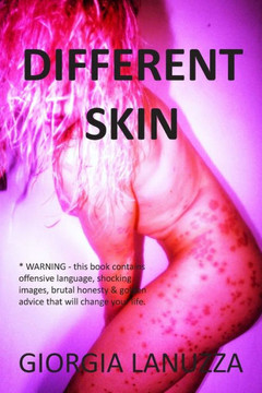 Different Skin