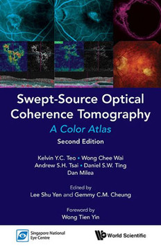 Swept-Source Optical Coherence Tomography : A Color Atlas