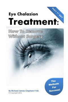 Eye Chalazion: How To Remove Without Surgery: My Personal Experience And The Methods I Used For Success (Chalazions, Styes, Cysts: Eye Treatment At Home Without Surgery)