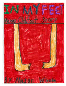 In My Feet: Mason's Clubfoot Story