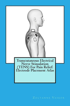 Transcutaneous Electrical Nerve Stimulation For Pain Relief : Electrode Placement Atlas
