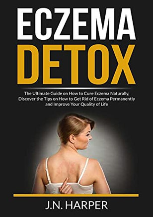 Eczema Detox: The Ultimate Guide On How To Cure Eczema Naturally, Discover The Tips On How To Get Rid Of Eczema Permanently And Improve Your Quality Of Life