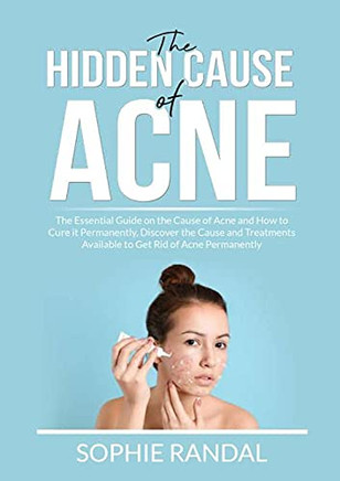 The Hidden Cause Of Acne: The Essential Guide On The Cause Of Acne And How To Cure It Permanently, Discover The Cause And Treatments Available To Get Rid Of Acne Permanently