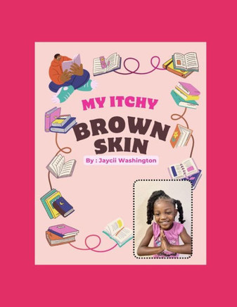 My Itchy Brown Skin