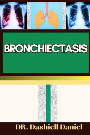 Bronchiectasis: Expert Guide to bronchiectasis Causes, Symptoms, Treatment, and Achieving Complete Wellness Bronchiectasis: Expert Guide to bronchiectasis Causes, Symptoms, Treatment, and Achieving Complete Wellness