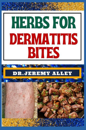 Herbs for Dermatitis Bites: Nature's Soothing Solutions: Unlocking The Power To Conquer Insect Disease Naturally