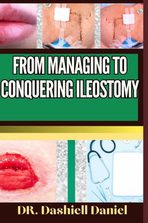 From Managing to Conquering Ileostomy: Expert Guide To Understanding the Causes, Recognizing Symptoms, Prevention and Embracing Effective Treatments f