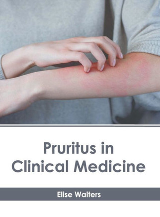 Pruritus in Clinical Medicine