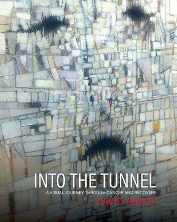 Into the Tunnel: A Visual Journey through Cancer and Recovery