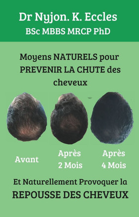 Moyens NATURELS pour Prévenir la chute des cheveux: Et naturellement provoquer la REPOUSSE DES CHEVEUX