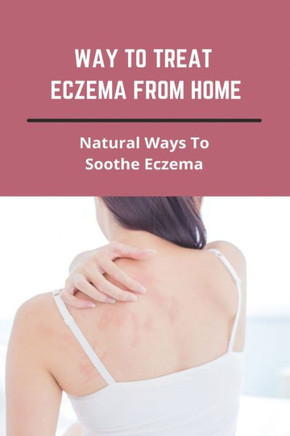 Way To Treat Eczema From Home: Natural Ways To Soothe Eczema: How To Treat Eczema Through Diet