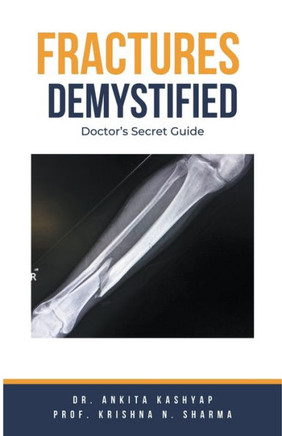Fractures Demystified: Doctor's Secret Guide