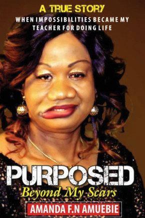 Purposed Beyond My Scars: When impossibilities Became My Teacher For Doing Life
