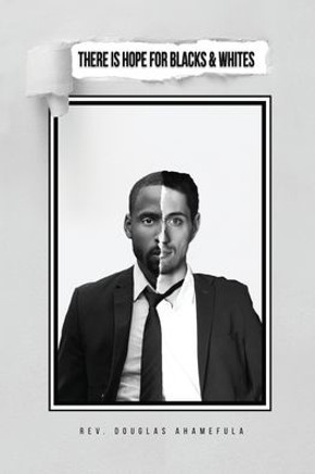 There Is Hope For Blacks & Whites