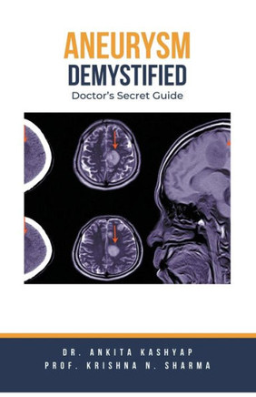 Aneurysm Demystified: Doctor's Secret Guide