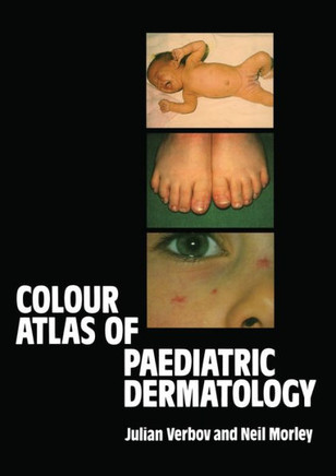 Colour Atlas of Paediatric Dermatology