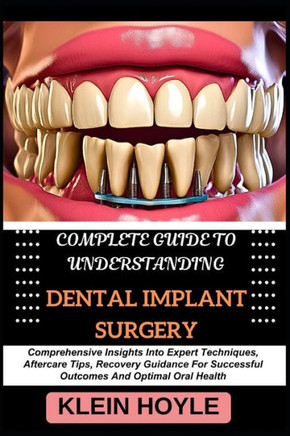 Complete Guide to Understanding Dental Implant Surgery: Comprehensive Insights Into Expert Techniques, Aftercare Tips, Recovery Guidance For Successfu