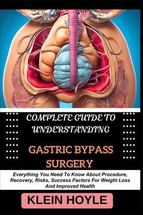 Complete Guide to Understanding Gastric Bypass Surgery: Everything You Need To Know About Procedure, Recovery, Risks, Success Factors For Weight Loss
