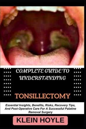 Complete Guide to Understanding Tonsillectomy: Essential Insights, Benefits, Risks, Recovery Tips, And Post-Operative Care For A Successful Palatine R