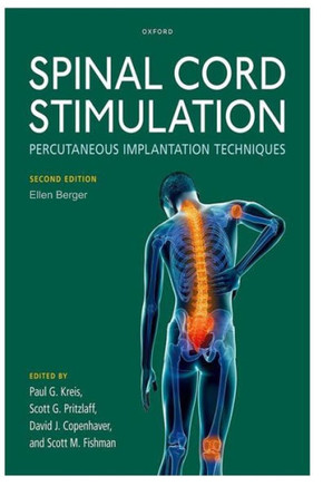 Spinal Cord Stimulation