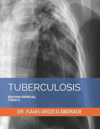 Tuberculosis: Edicion Especial. Tomo II