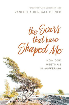 The Scars That Have Shaped Me : How God Meets Us In Suffering