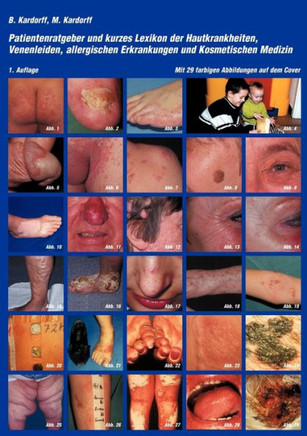 Patientenratgeber und kurzes Lexikon der Hautkrankheiten, Venenleiden, allergischen Erkrankungen und kosmetischen Medizin