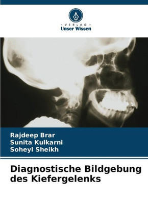 Diagnostische Bildgebung des Kiefergelenks