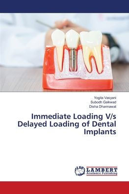 Immediate Loading V/s Delayed Loading of Dental Implants
