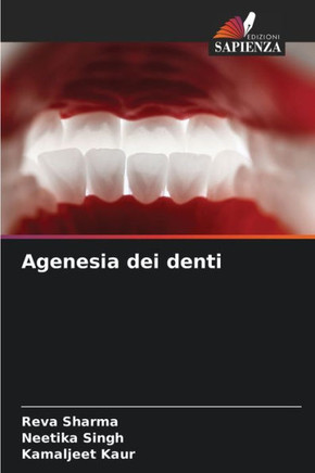 Agenesia dei denti