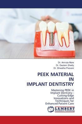 Peek Material in Implant Dentistry