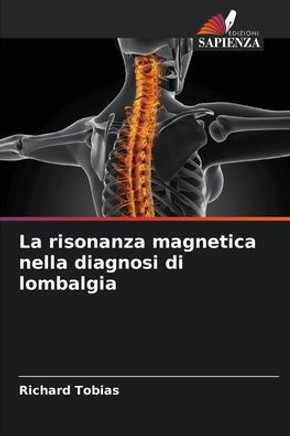 La risonanza magnetica nella diagnosi di lombalgia