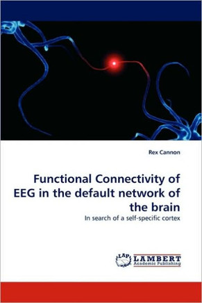 Functional Connectivity of Eeg in the Default Network of the Brain