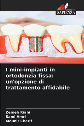 I mini-impianti in ortodonzia fissa: un'opzione di trattamento affidabile