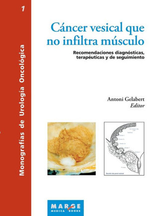C?cer vesical que no infiltra m?culo: Recomendaciones diagn?ticas, terap?ticas y de seguimiento