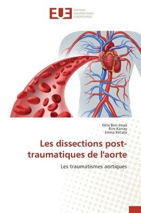 Les dissections post-traumatiques de l'aorte