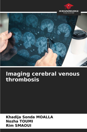 Imaging cerebral venous thrombosis Imaging cerebral venous thrombosis