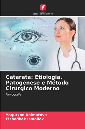 Catarata: Etiologia, Patog?ese e M?odo Cir?gico Moderno