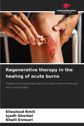 Regenerative therapy in the healing of acute burns