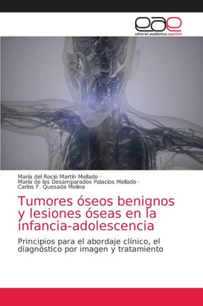 Tumores ?eos benignos y lesiones ?eas en la infancia-adolescencia