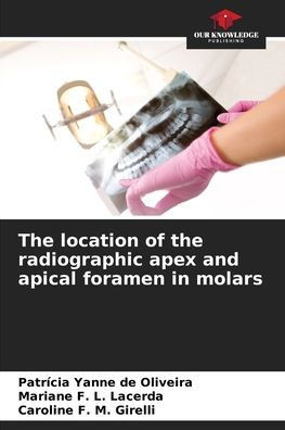 The location of the radiographic apex and apical foramen in molars