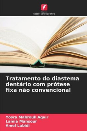 Tratamento do diastema dentário com prótese fixa não convencional