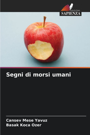 Segni di morsi umani