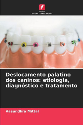 Deslocamento palatino dos caninos: etiologia, diagnóstico e tratamento