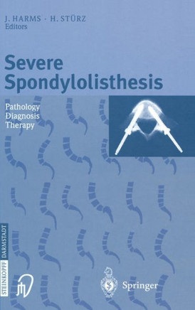 Severe Spondylolisthesis: Pathology - Diagnosis - Therapy